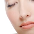 Botox In Los Angeles: What You Need To Know